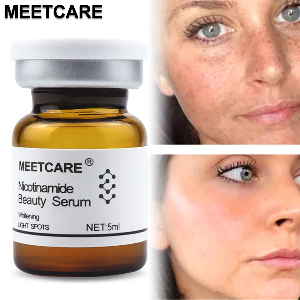 5ml נמש כתמים כהים הסרת הפנים תמצית Nicotinamide טבעי תמצית סרום עבור מזותרפיה Microneedle Dermapen הלבנת